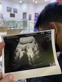 dhea wulandary profile icon