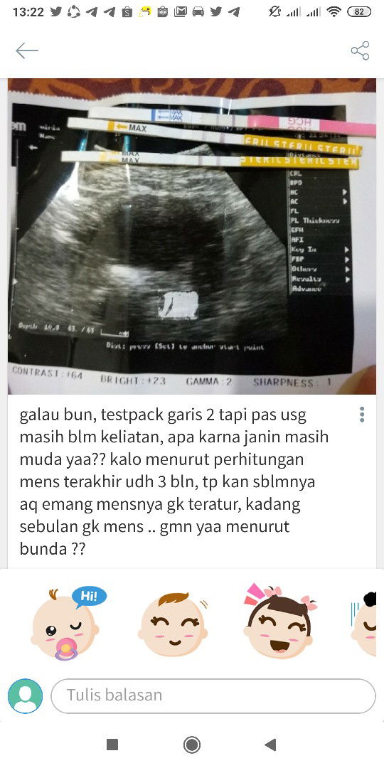 15week alhamdulillah udh keliatan
