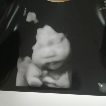 31week