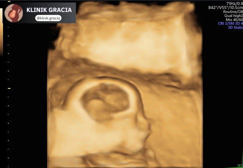 Putri Ch profile icon