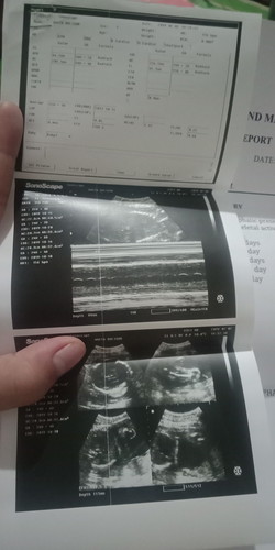 #UltraResult