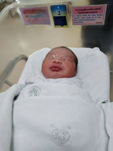 หลังจากที่สอบถามอาการปวดท้องเมื่อวาน