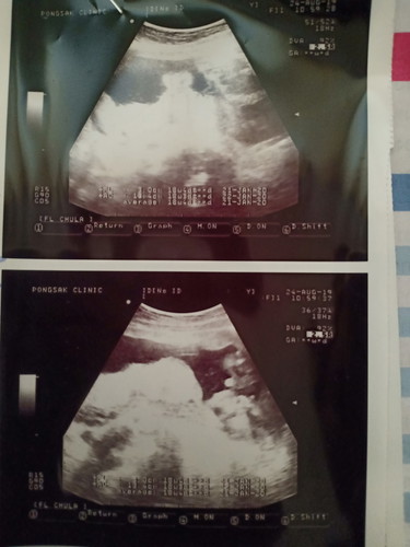 ช่วยดูให้หน่อย