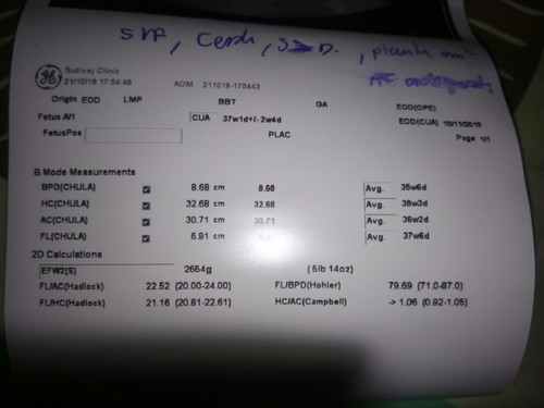 อายุครรภ์