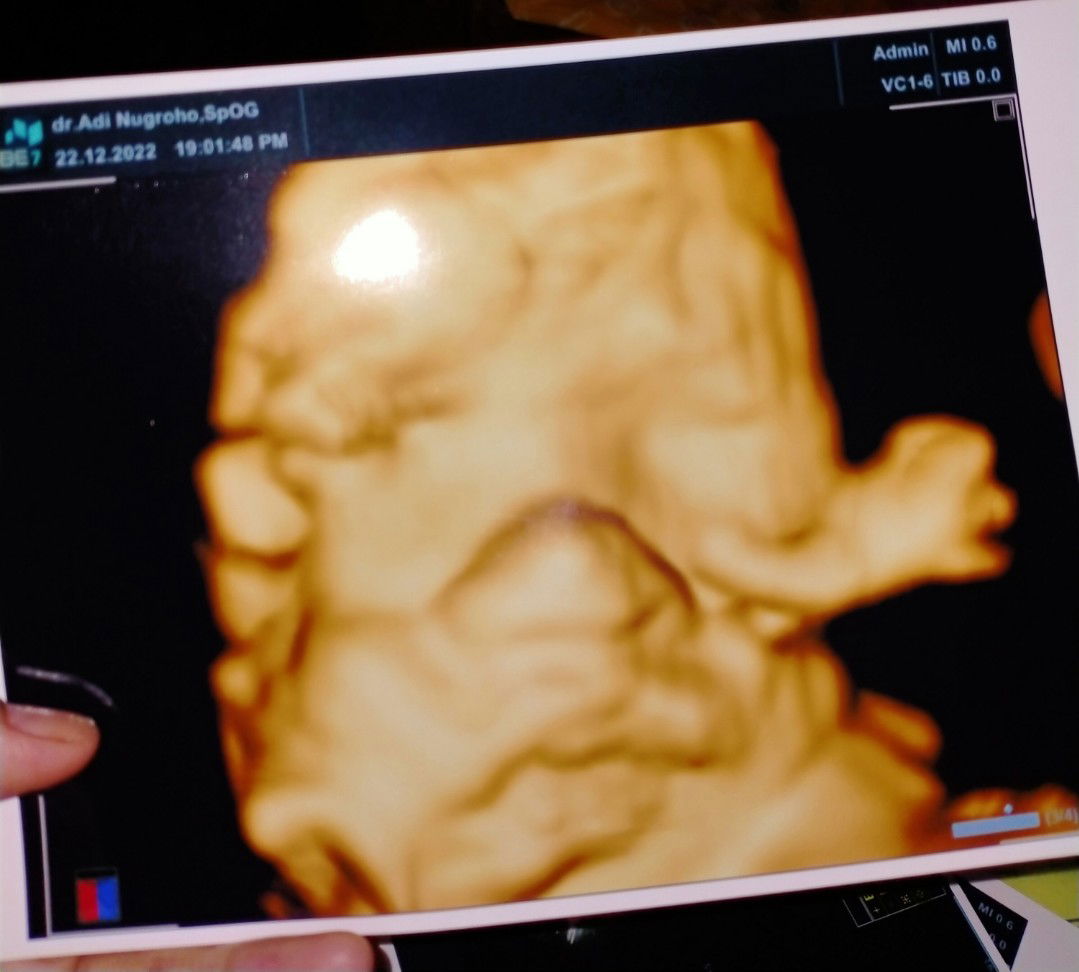 Fera Aulia profile icon