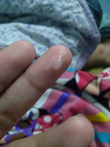 มูกใสหรือตกขาว