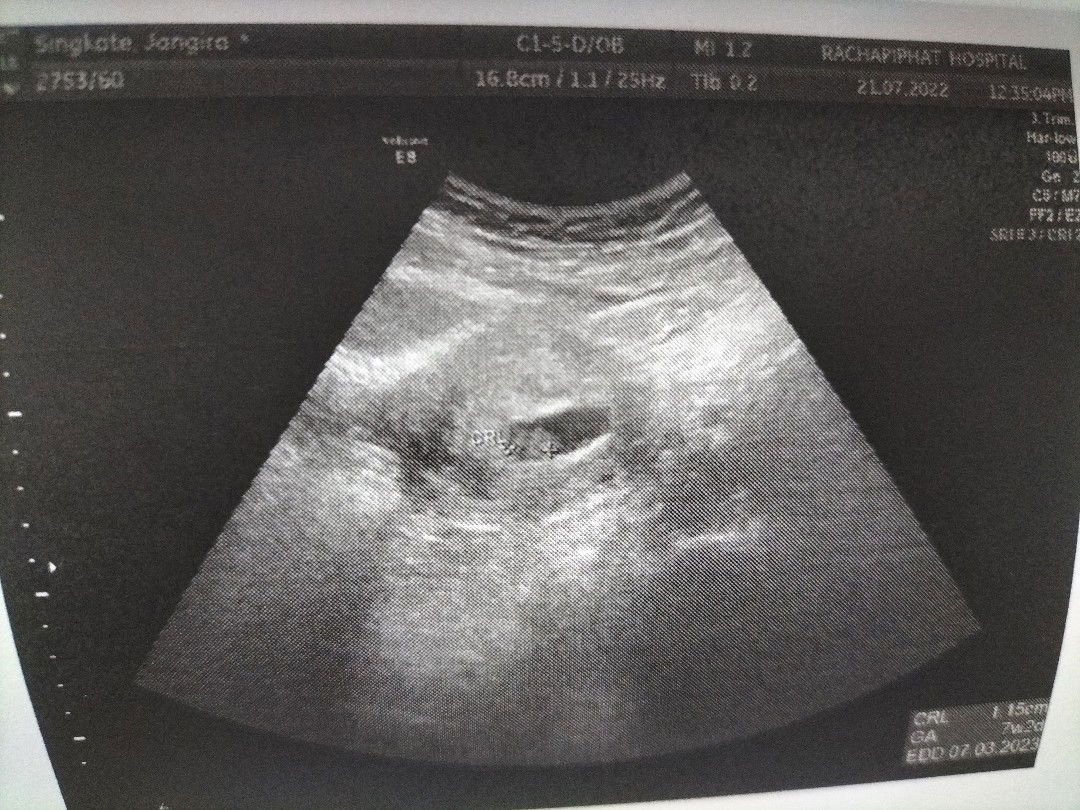 Jan Janjira Suton profile icon