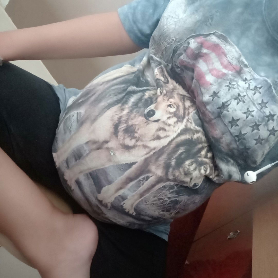 ผ่าคลอด