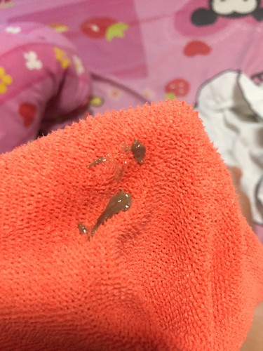 ขออนุญาติค่ะ สีน้ำตาลออกมาจากช่องคลอดแบบนี้คืออะไรค่ะ คือเราพึ่งไปเข้าห้องน้ำมาเเล้วมีออกมาจากช่องคลอดค่ะ