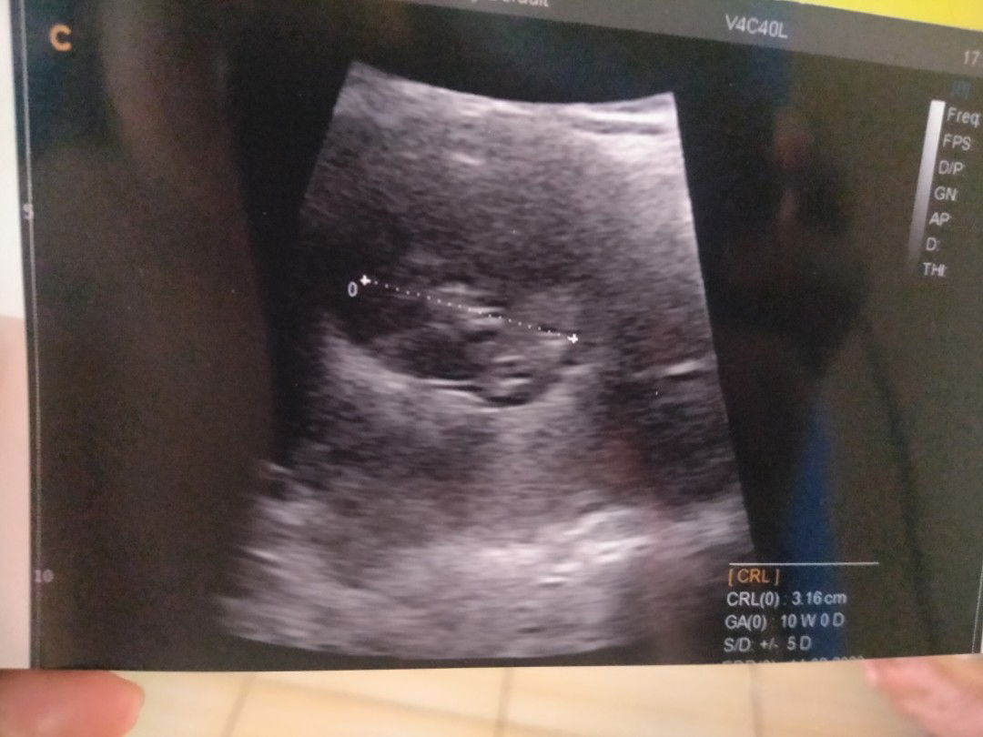 INDHAH LESTARI profile icon