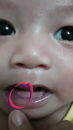 puti butlig ss gums n baby
