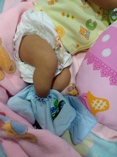 ทารกแรกเกิด