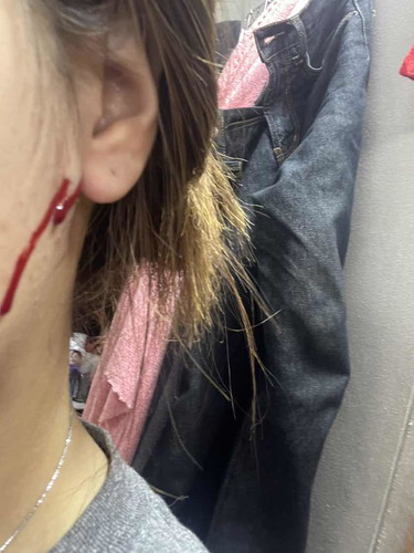 เป็นก้อนไตที่หน้า ไปหาหมอให้ผ่าออกได้ไหมคะ ตั้งครรภ์15w