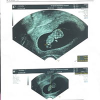 Unchalee Tiprod profile icon