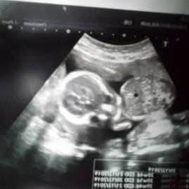 รูปใบซาว