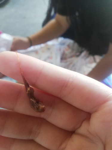 คืออะไรค่ะแบบนี้