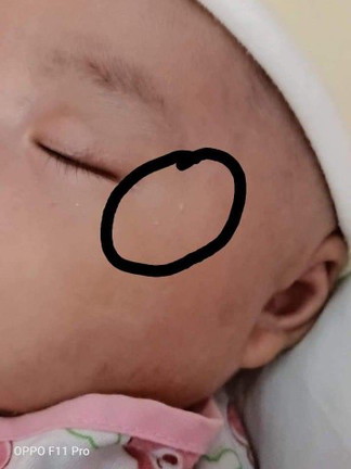 จุดขาวๆๆเกิดจากอะไร