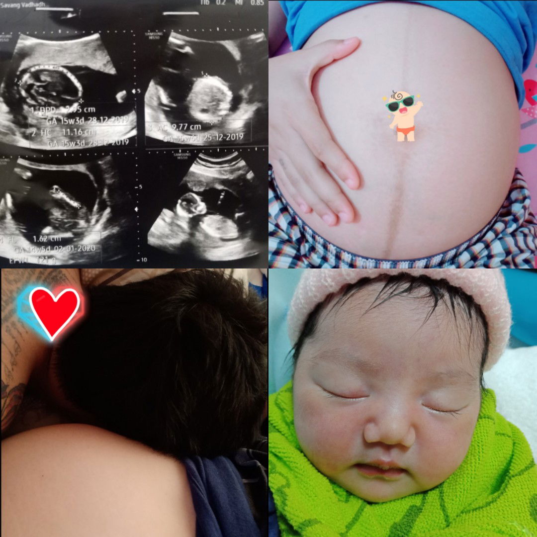 ประสบการณ์ยาวาฟาริน + ลูกน้อยในท้อง