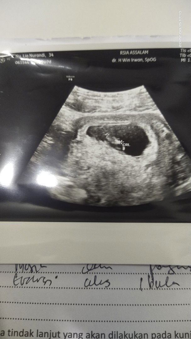 Lia nurandi profile icon