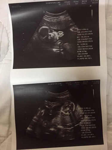 24w