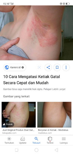 gatal gatal saat hamil seperti ruam .. di ketiak