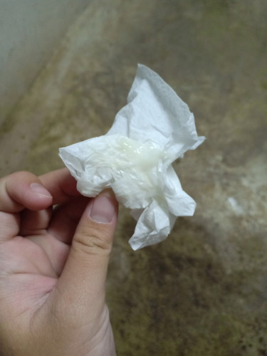 นี้คือตกขาวใช้มัยค่ะ