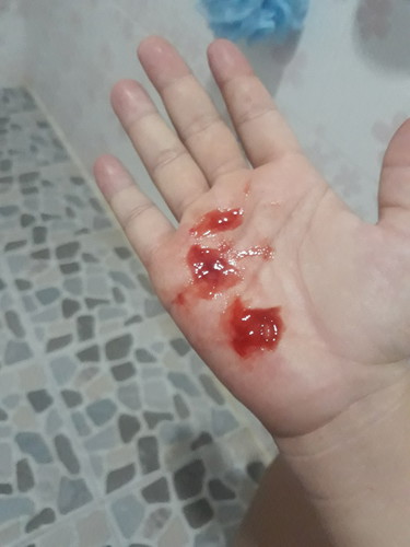 มูกเลือด