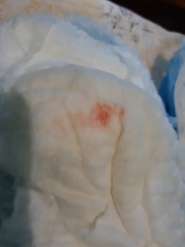 Bercak merah pada pampers