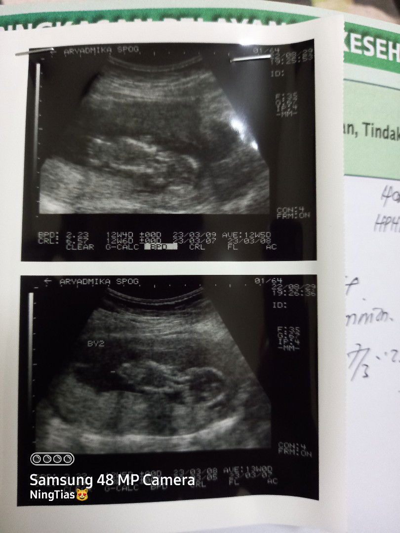 ning tias irawan profile icon