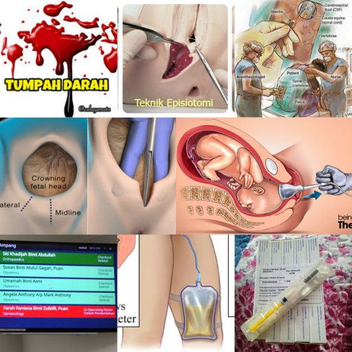 Proses melahirkan Adra Aliesya..??