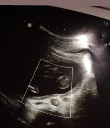 คุณแม่มีวิธีไหนบำรุงลูกน้อยบ้างคะ