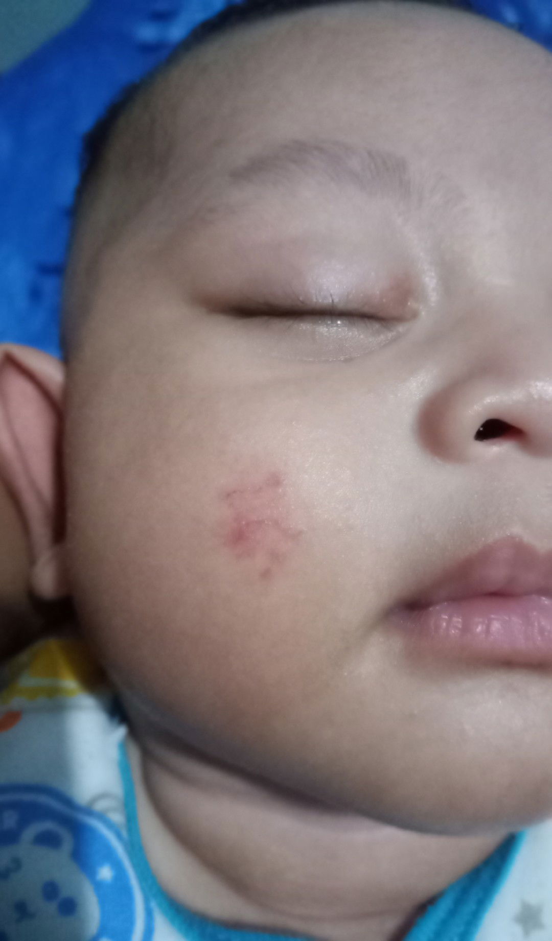 tanda lahir bukan yah?