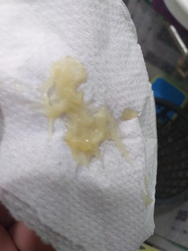 mucus plug?