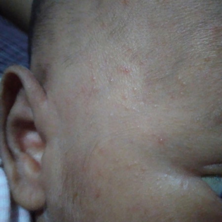 apa solusinya mom?