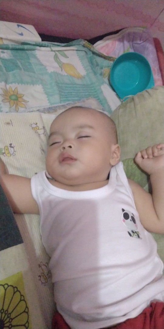 Ubun-ubun Menggembung