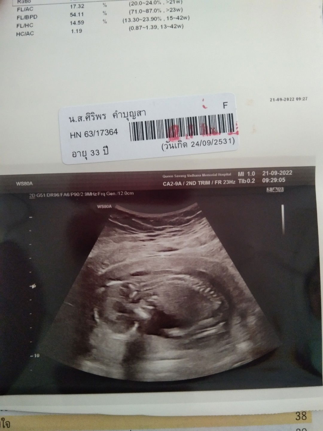 ศิริพร คำบุญสา profile icon