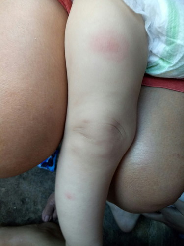 PANTAL NA NANGINGITIM