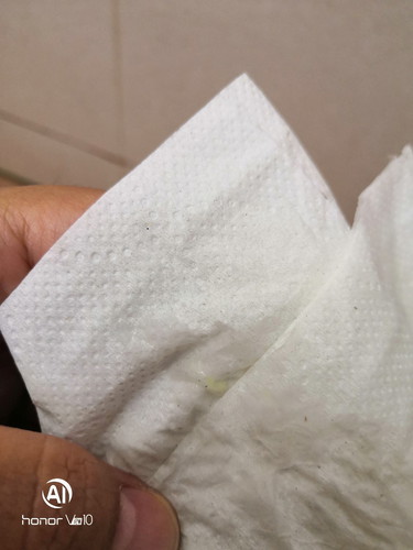 Hamil Tapi Keputihan Warna Pelik.?