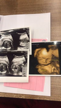 Nhira Pptngan profile icon