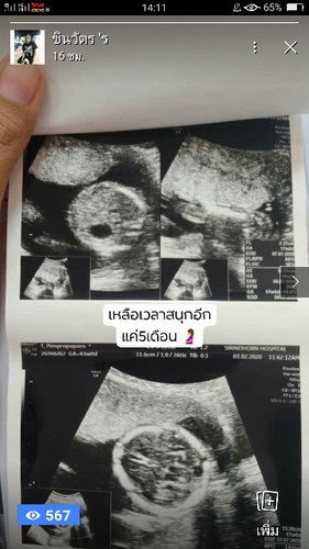 ขอดูรูปอันตร้าซาวด์แต่ละบ้านหน่อยครับ