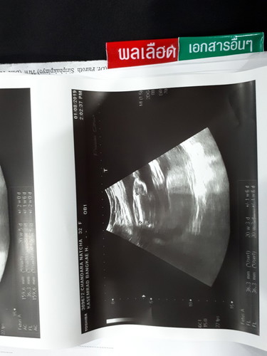 ญ หรือ ช ช่วยบอกที
