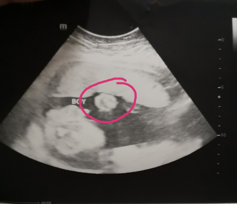 baby gender. first time mom here, curious lang po :)