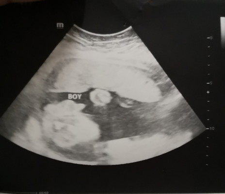 its a boy?