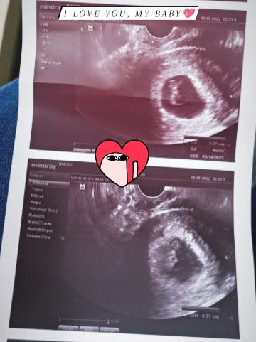 Ann Roberts profile icon