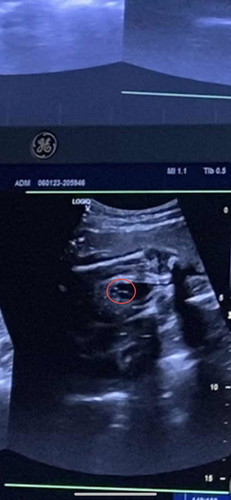 ช่วยดูหน่อยค่ะว่าเพศหญิงหรือชาย