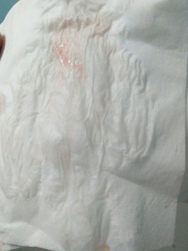 38+2วีค มีมูกแบบนี้ออกมาคืออะไรค่ะ