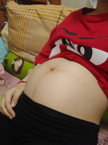ท้อง8เดือน