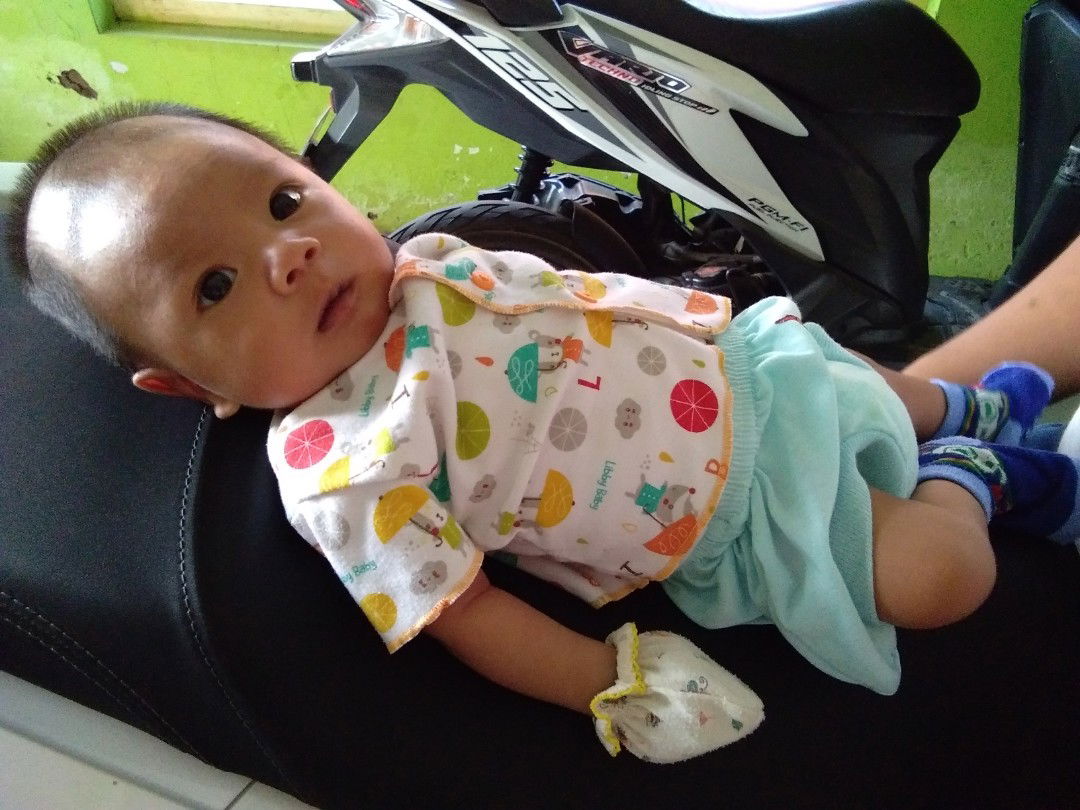 kepala bayi lonjong