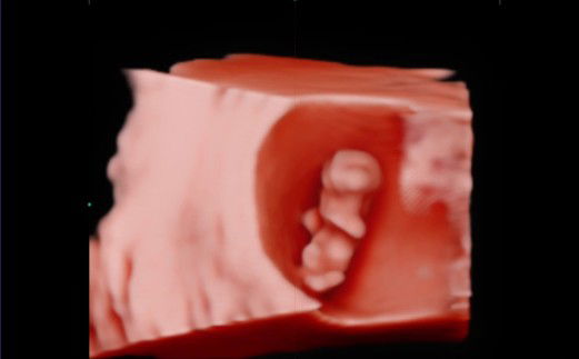 Siriwan Kaew profile icon