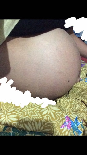 ท้องลดลงหรือเปล่า